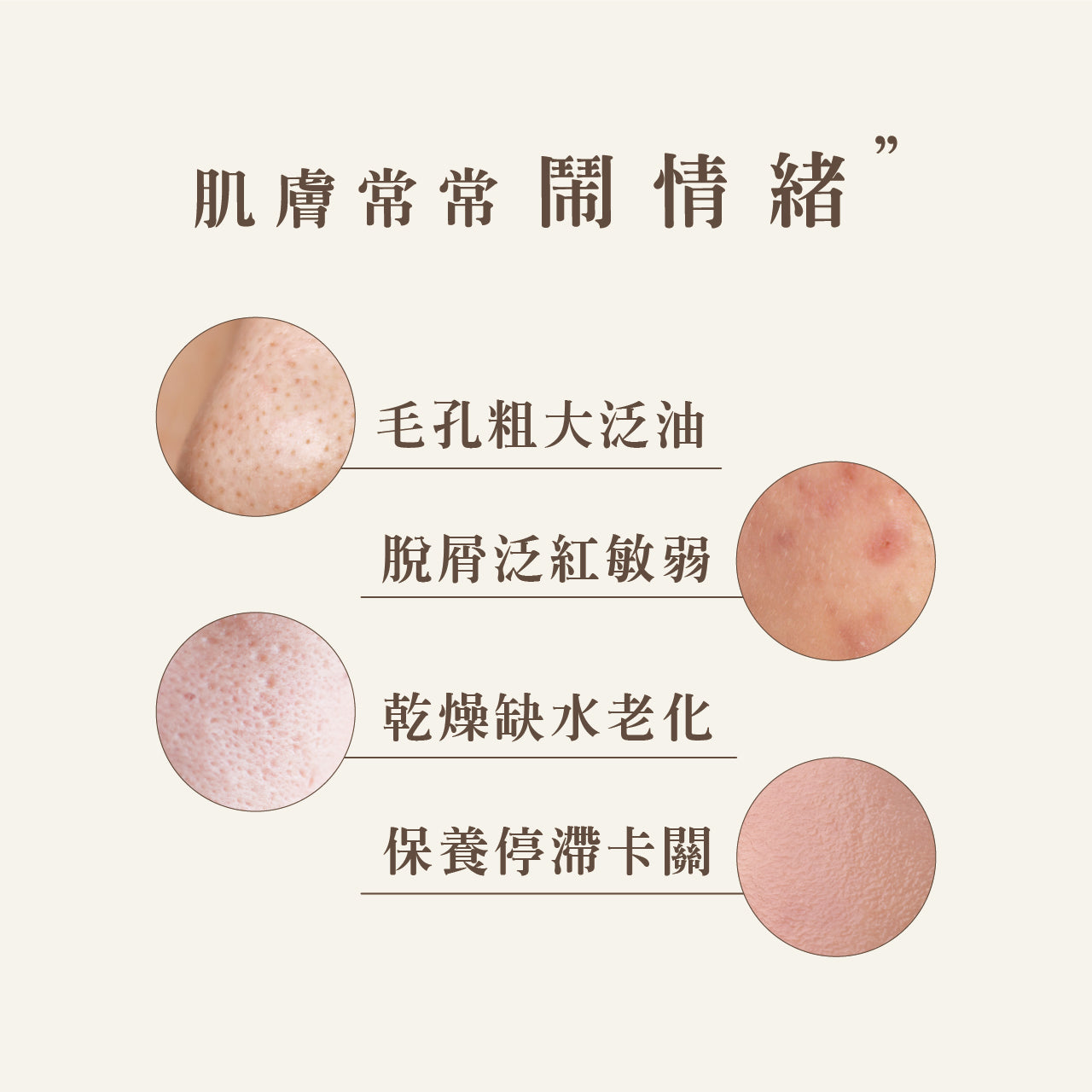 【全新完好無缺】台灣 SHEN 經典款 金盞花舒緩調理潤膚水 125ml